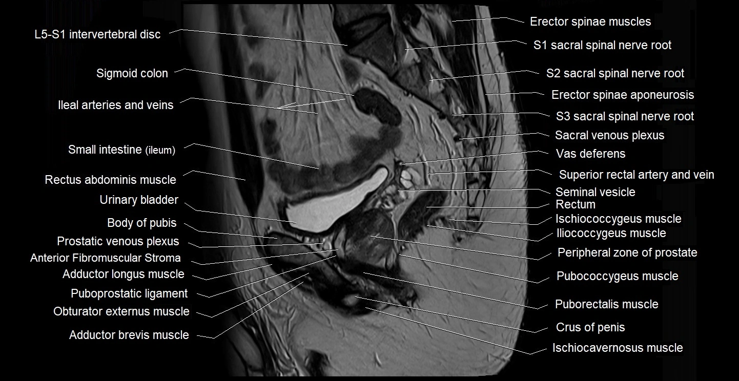 male pelvis sagittal cross sectional anatomy 3T mri image 27.webp